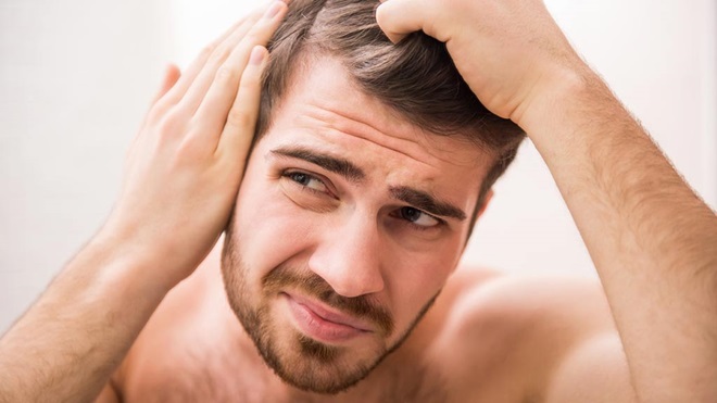 man looking at hairline hairloss lead